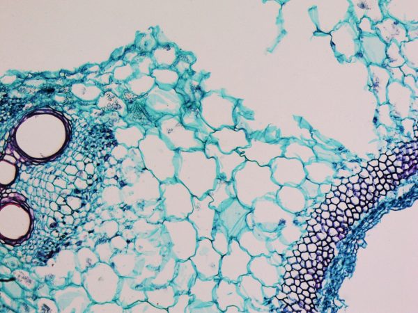 Light photomicrograph of Cucurbita stem cross section seen through microscope